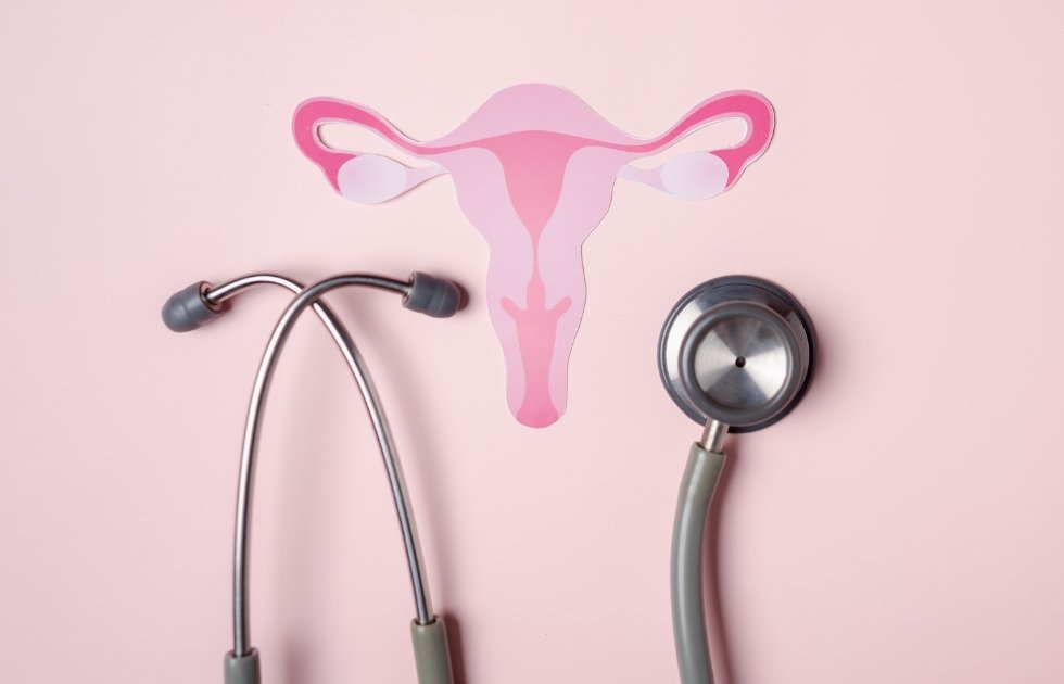 Picture of uterus with PCOS and stethoscope