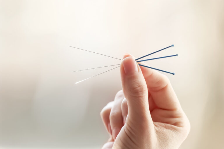 How Much Acupuncture Should You do to Improve Your IVF Outcomes?