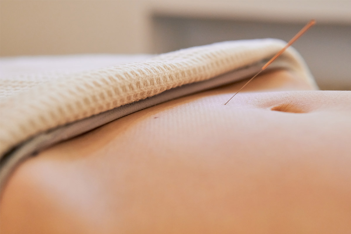 When is the Best Time to Get Fertility Acupuncture?